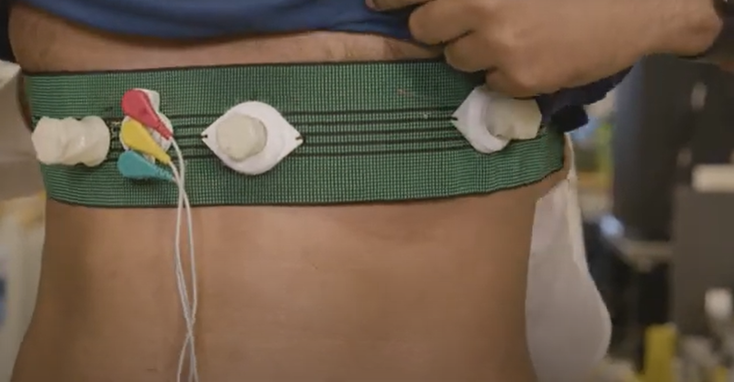 A team at Simon Fraser University has built a soft chest belt with 3D printed suction cup electrodes and built in AI that can pre diagnose 10 types of irregular heart rhythms, offering cleaner, faster monitoring in hospitals and remote communities.