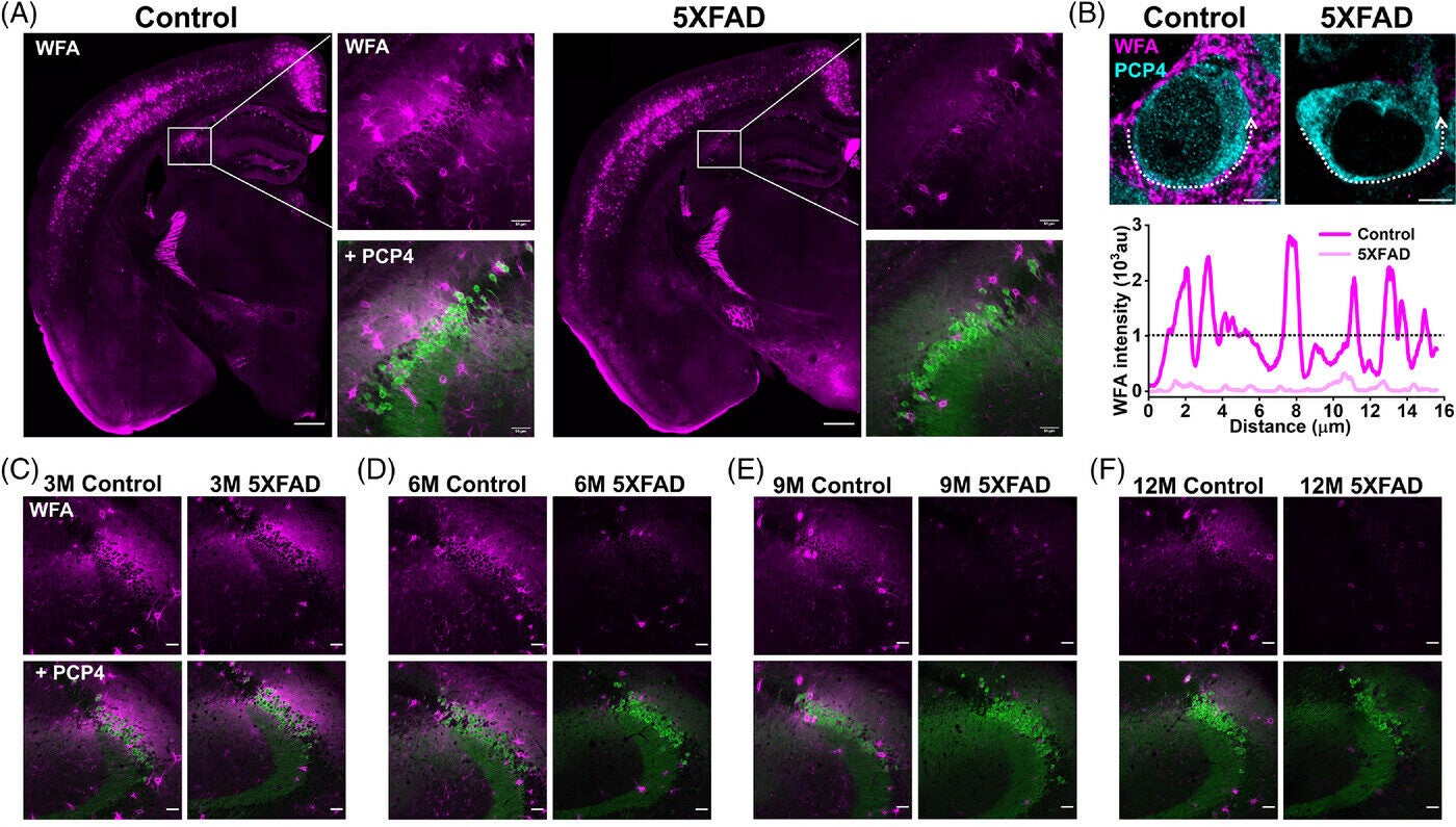 Progressive disruption of Hippocampal CA2 PNNs in 5XFAD mice. Confocal micrographs showing immunohistochemical expression of WFA (magenta)-labeled PNNs in coronal half-brain sections from control and 5XFAD mice.