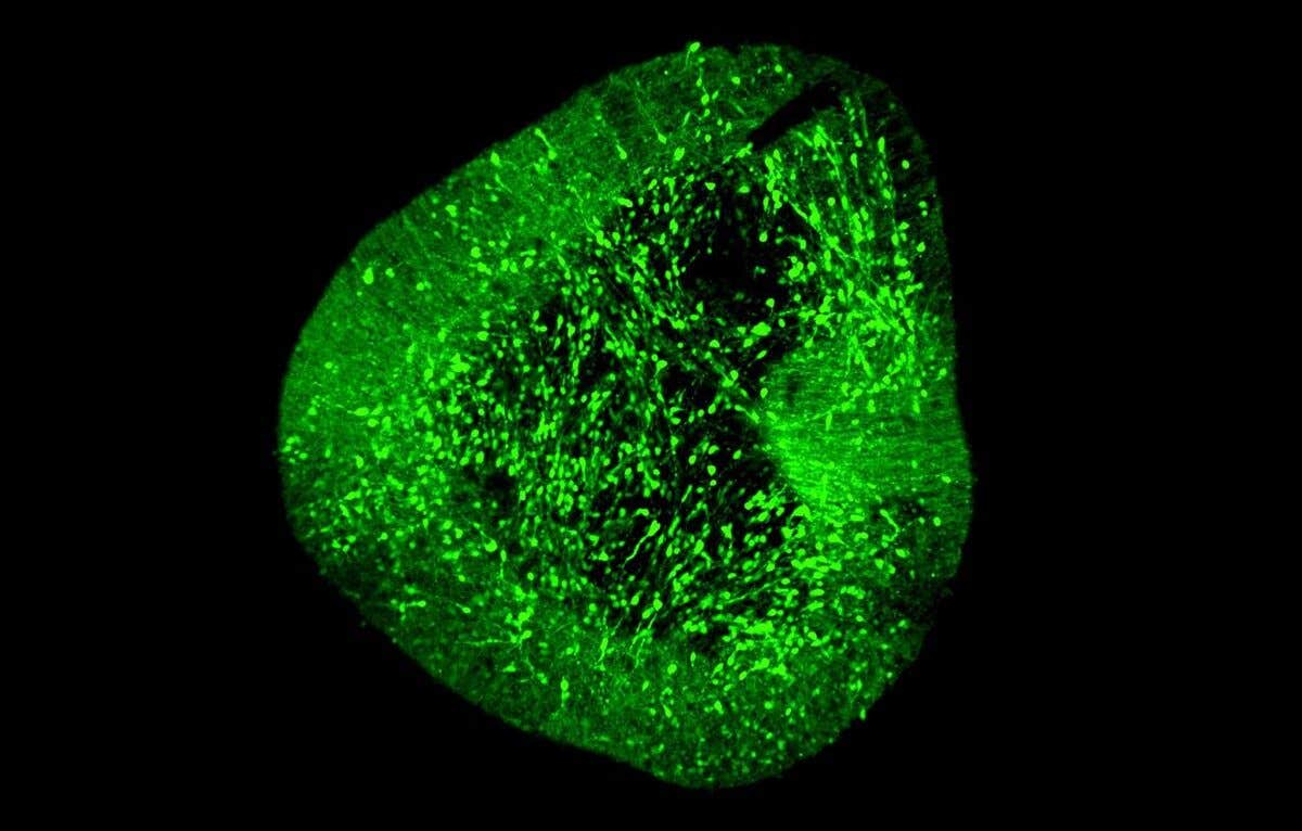Midbrain dopaminergic neurons under a microscope.