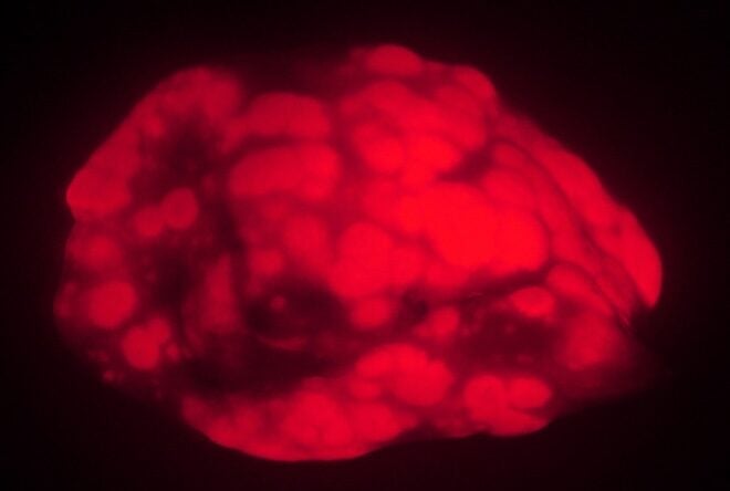 Old mice develop fewer and smaller lung tumors (red) than younger animals in a cancer model. The findings suggest that, in very old animals or humans, the aging process suppresses cancer formation.