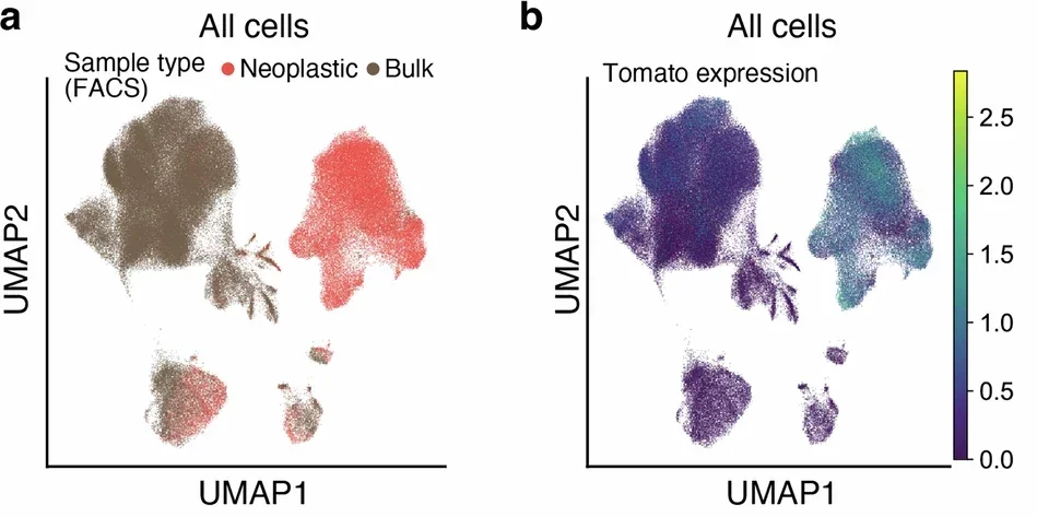 Uniform Manifold Approximation and Projection (UMAP) embedding of cells colored by whether they were sorted as ‘neoplastic cells’ or ‘bulk cells’
