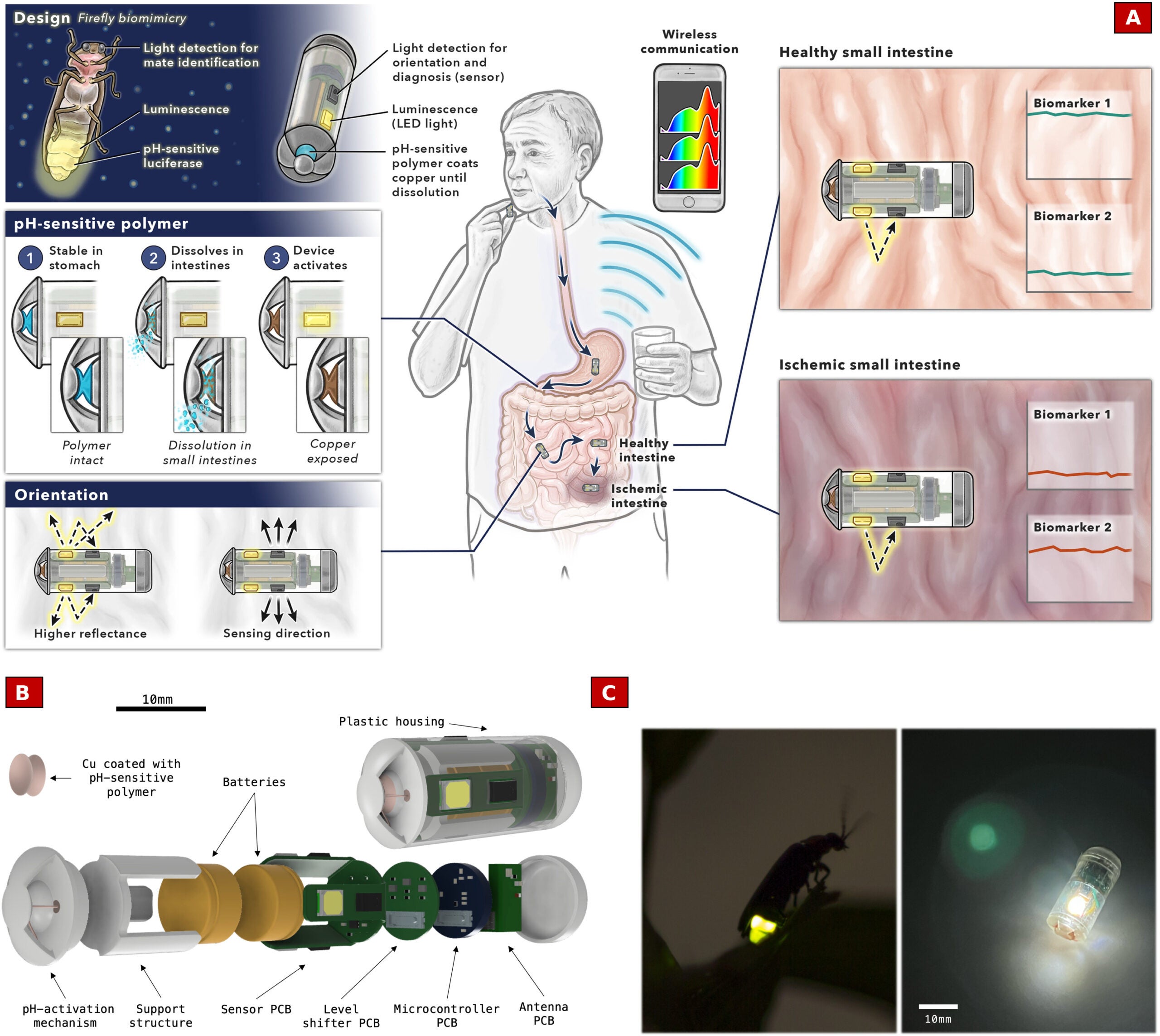 Overview of the bioinspired design of the ingestible device for diagnosing mesenteric ischemia.