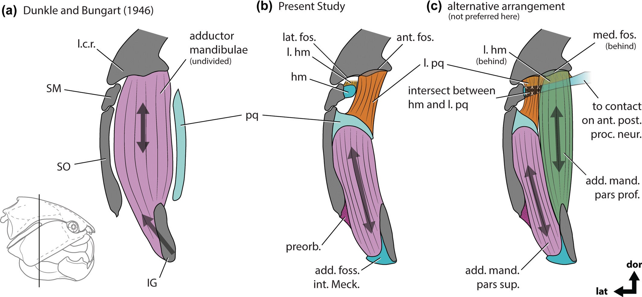 Muscle reconstruction of Dunkleosteus terrelli in transverse view, comparing the reconstruction in Dunkle and Bungart (1946) (a, redrawn and modified from that study) to that favored in the present analysis (b), and an alternative arrangement where the m. adductor mandibulae is divided into multiple branches with a deep branch originating on the lateral consolidated region (c).