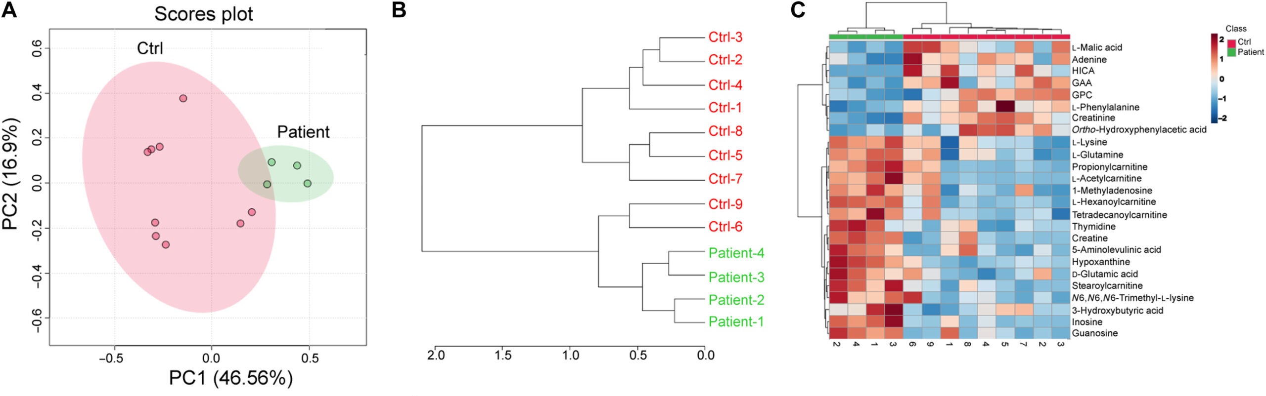Patient blood plasma exhibit disrupted systemic metabolic homeostasis.