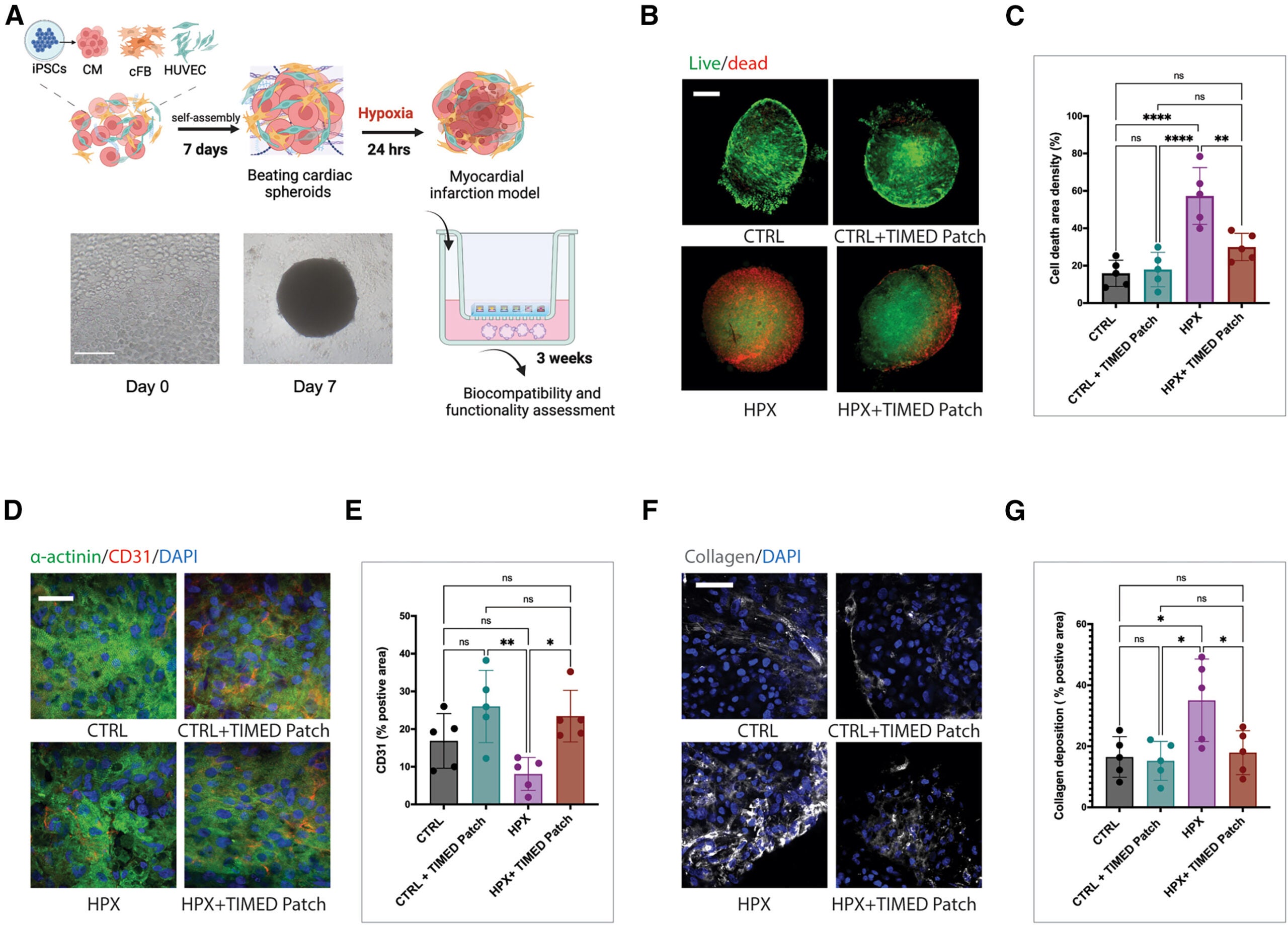  In vitro validation of a proof-of-concept cardiac combination therapy with TIMED system