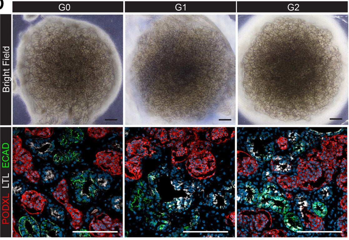 Establishment of AMKD patient and isogenic G0G0 iPSC lines to generate kidney organoids
