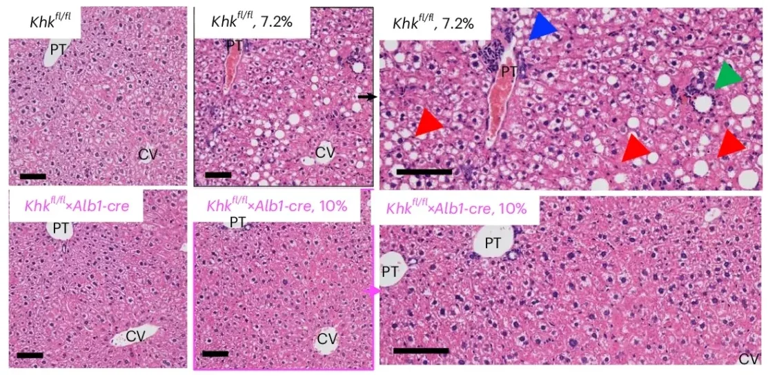 Representative haematoxylin and eosin images in livers of mice. Right: Image magnification demonstrating steatotic (red arrows) areas, lipogranulomas (green arrow) and inflammation (blue arrows) PT: portal triad, CV: central vein. 