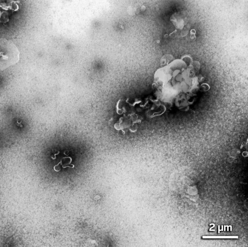 Elaine Bearer found that the microplastic clumps taken from brain samples are actually clusters of hook-shaped nanoplastics