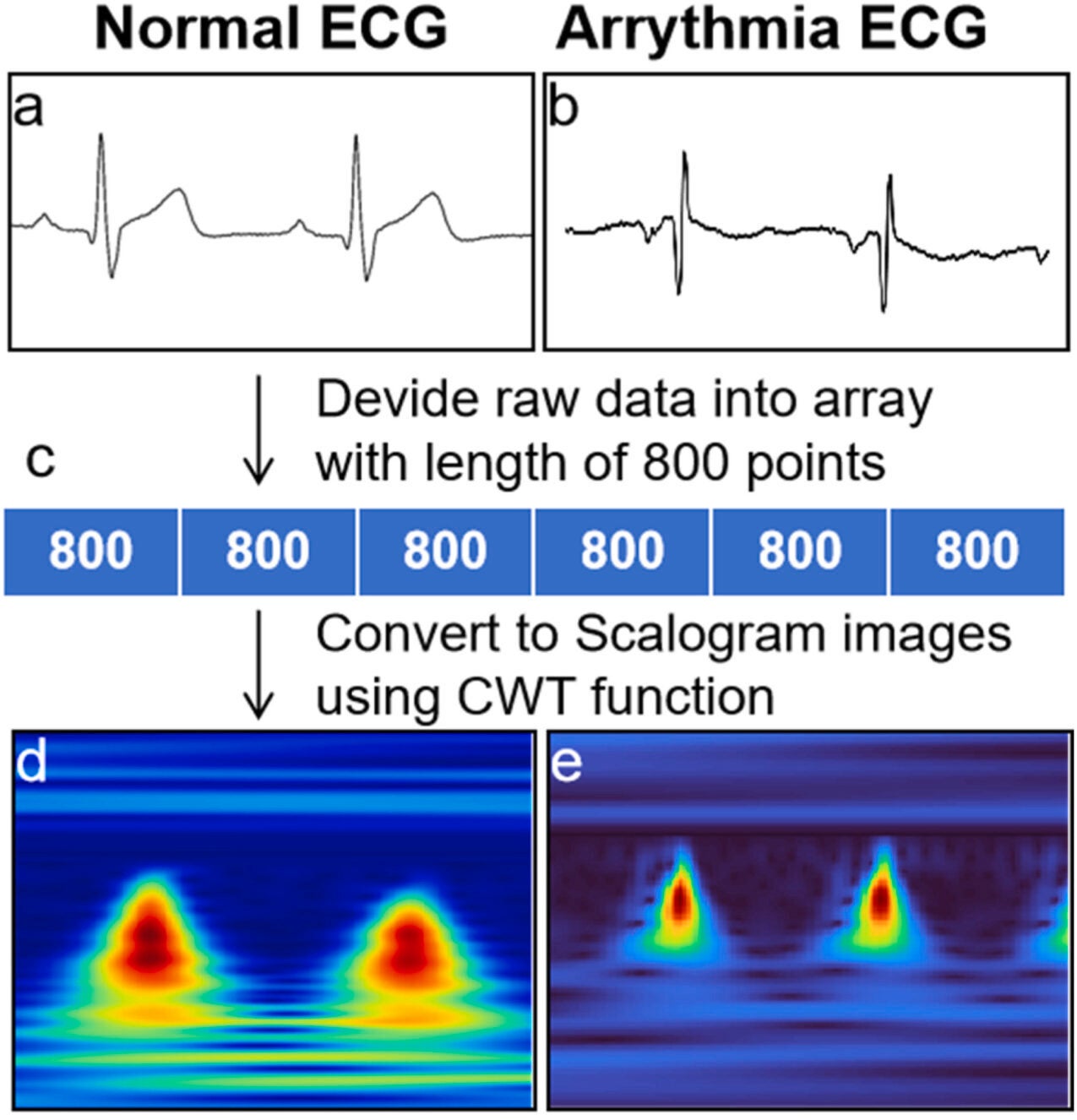 ECG classification using scalograms and CNN.