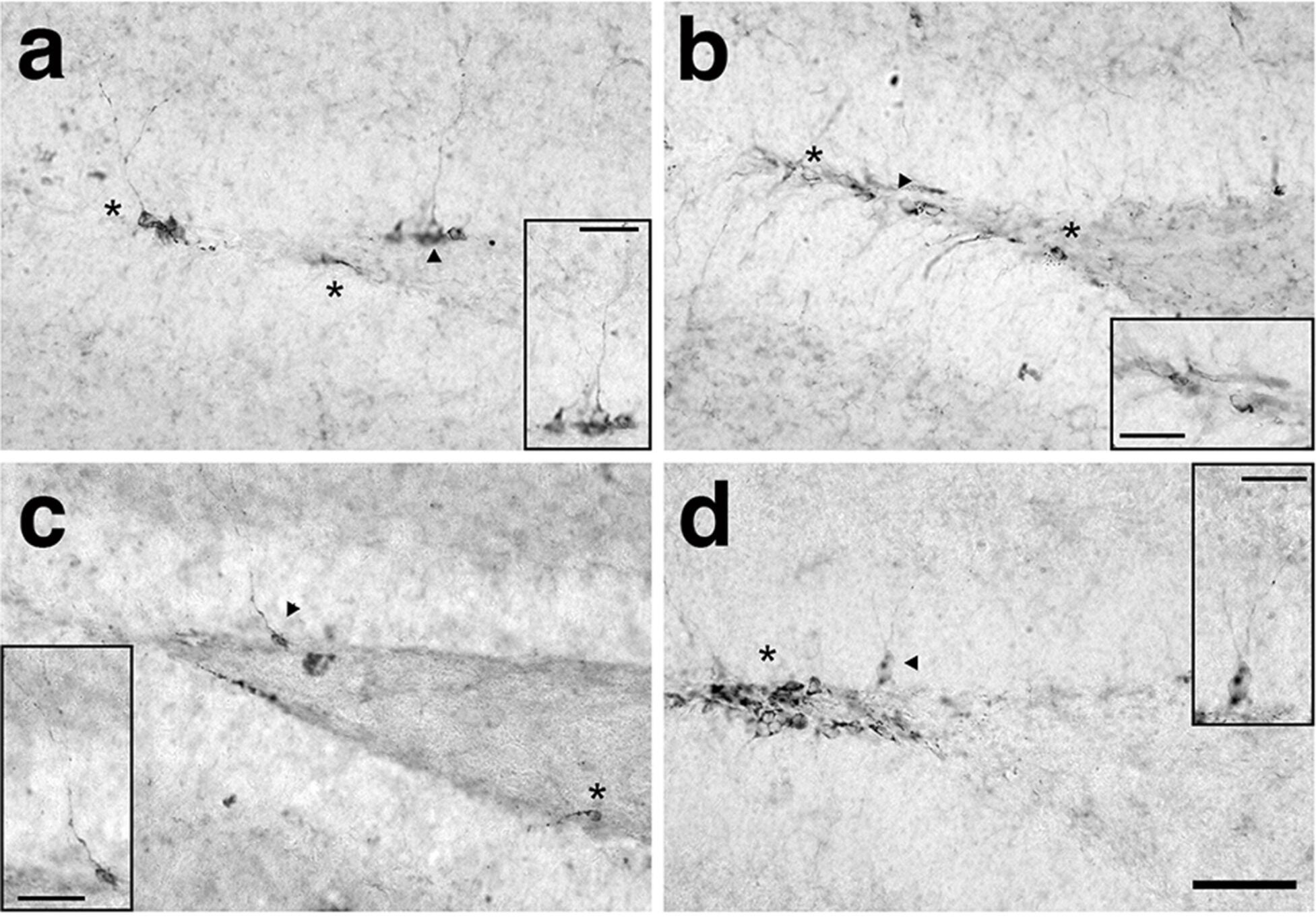 Ctsb treatment improves adult neurogenesis in AD mice. (a–d) Representative photomicrographs of the dentate gyrus derived from (a) WT-Con; (b) WT-Ctsb; (c) AD-Con; (d) AD-Ctsb brain tissue sections subjected to DCX staining. 