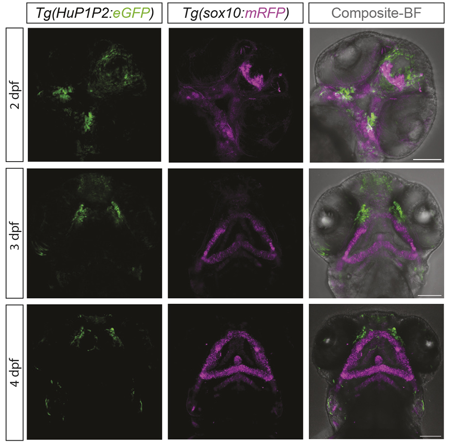 EC1.45 Peak1-2 is active during embryonic facial development in the frontonasal region and adjacent to the developing jaw.