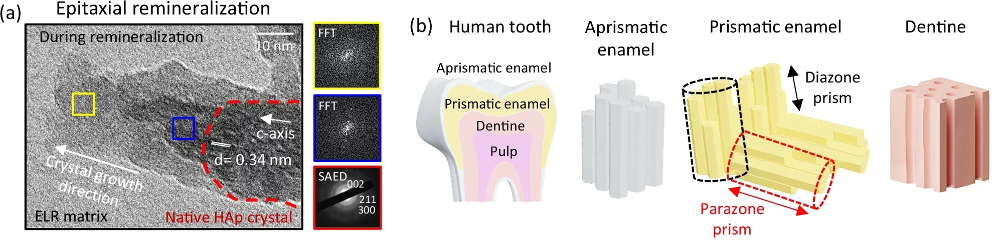 Epitaxial remineralization from different anatomical regions of the tooth.
