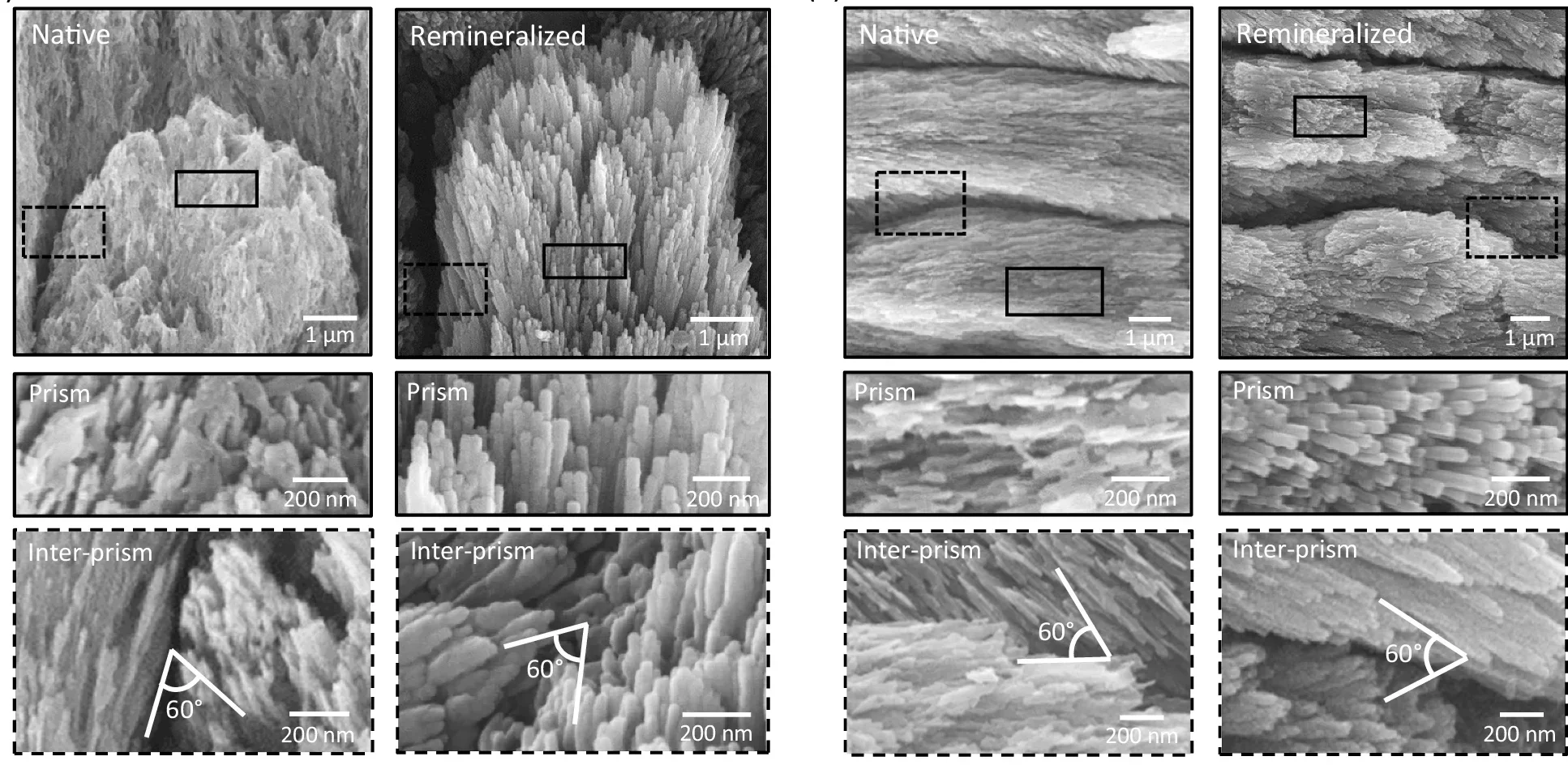 SEM images of native and remineralised diazone and parazone prisms, recreating enamel microarchitecture of both prism and inter-prisms