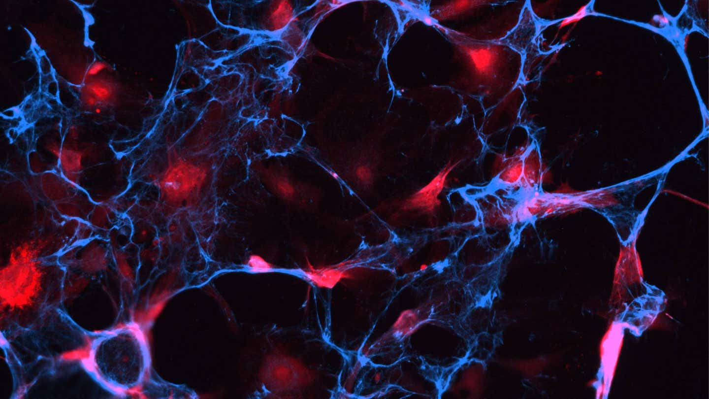 A confocal microscopy image shows senescent cells (red) tagged with molecules known as aptamers (blue).