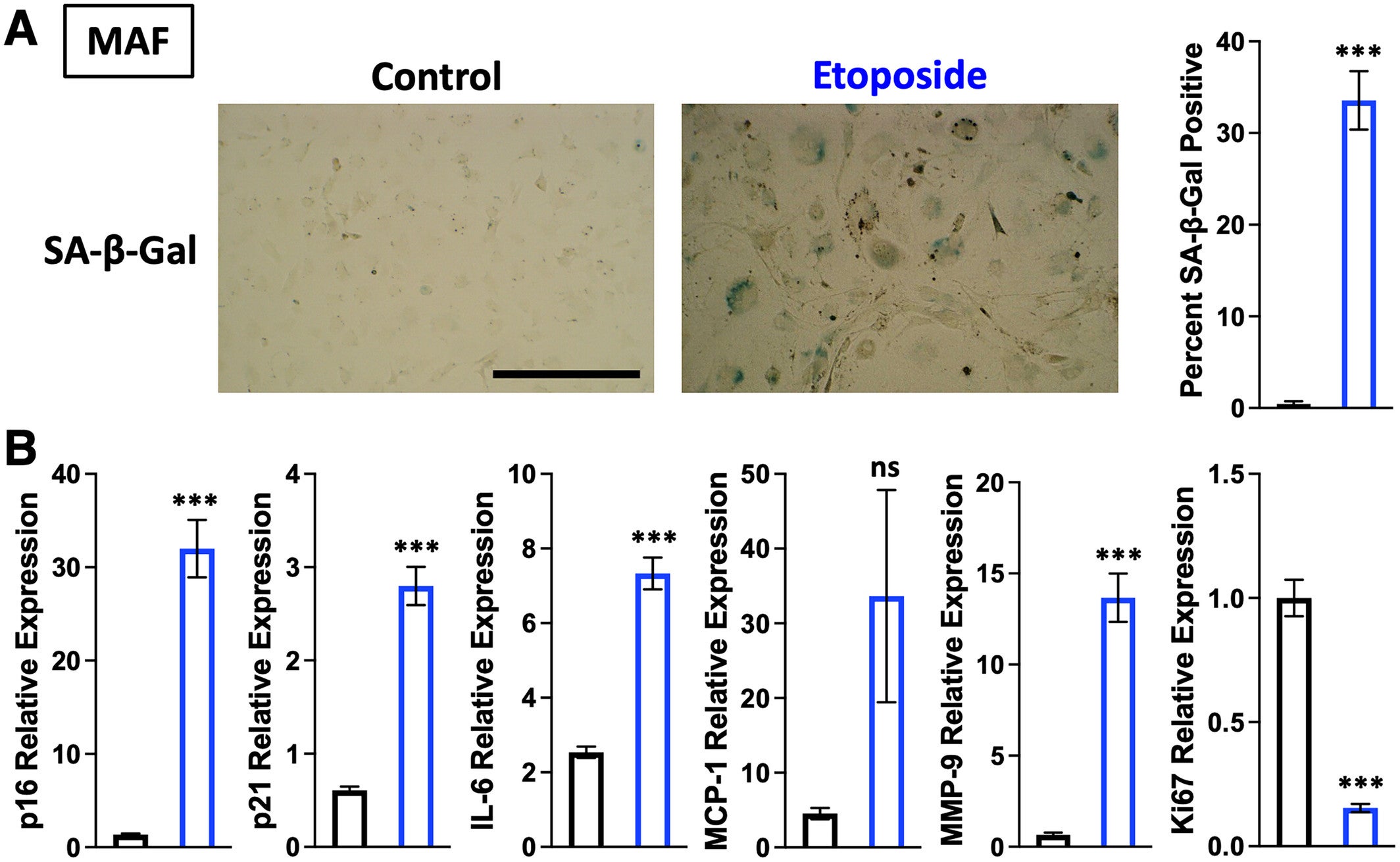 Validation of senescent phenotype in etoposide-challenged MAFs. Bright field images of control and etoposide-challenged MAFs show morphological changes and SA-β-Gal staining.