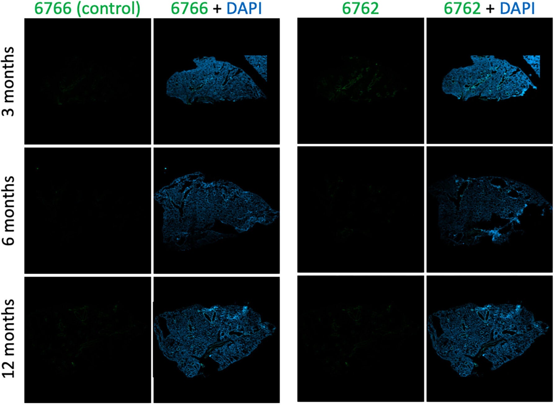 Aptamer 6762 staining of mouse lung tissue increases with age. Aptamer 6762 and negative control oligonucleotide 6766 are directly detected using the fluorescein label (green). Nuclei are stained with DAPI (blue). 