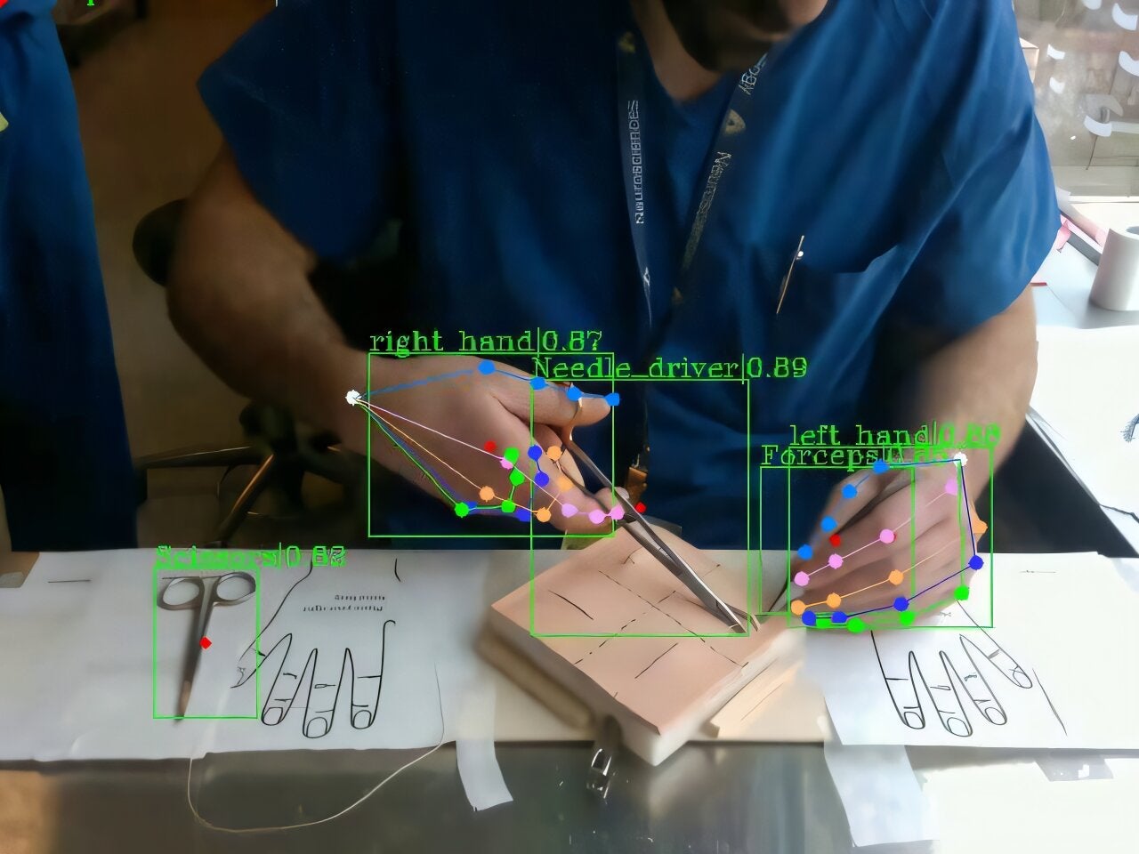 The team trained their model by tracking the hand movements of expert surgeons as they closed incisions. 
