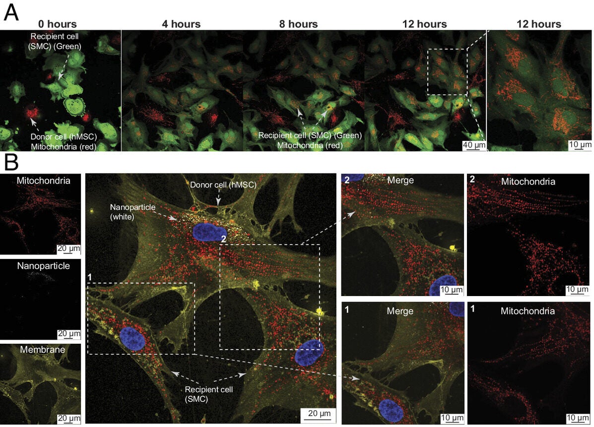 Effects of MoS2 nanoflowers on mitochondrial transfer between cells. 