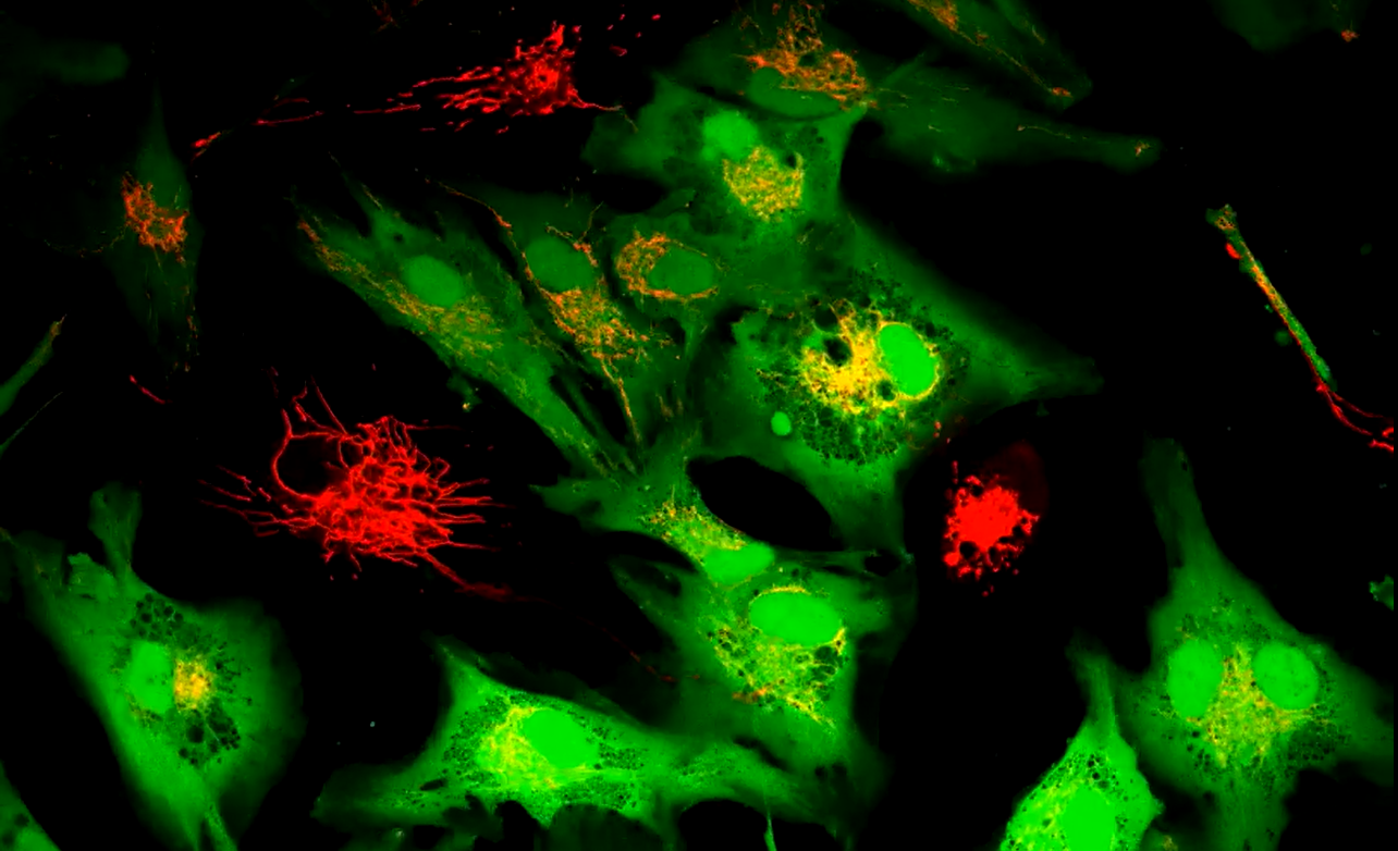 Researchers boosted stem cells to share extra mitochondria with failing cells, restoring energy and cutting damage in lab tests.