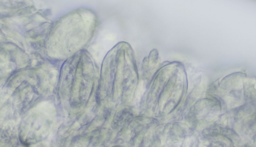 Nematocyst batteries from tentacle, paratype (TMBC030997).