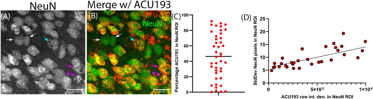 The abundance of neuronal ACU193+ AβOs correlates with NeuN signal heterogeneity.