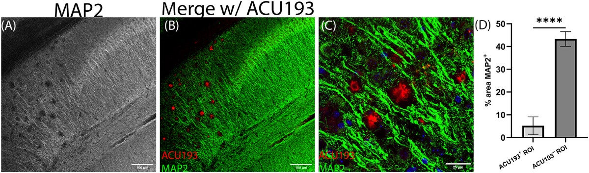 Extracellular AβO deposits localize in regions of dramatically reduced MAP2.