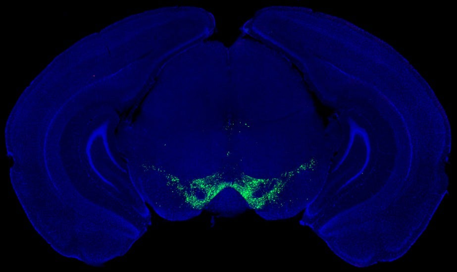 Fluorescence microscopy image of dopamine-producing neurons (green) in the midbrain of a mouse.