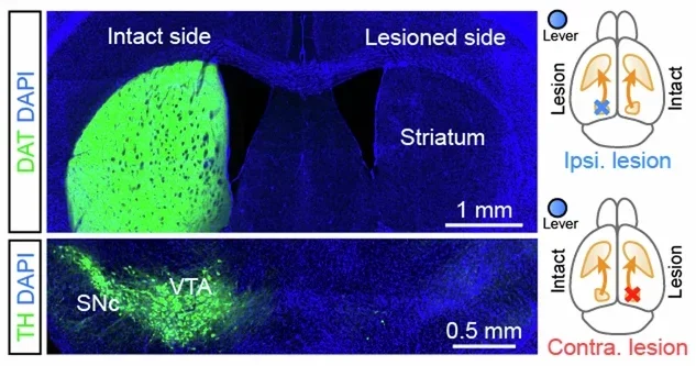 Left, fluorescence images of a 6OHDA-lesioned mouse forebrain (top) and ventral midbrain (bottom) in the coronal plane immunostained for DAT and TH to label DA axons and cell bodies, respectively. SNc, substantia nigra pars compacta; VTA, ventral tegmental area. Right, location of 6OHDA infusions relative to the lever-pressing forelimb.