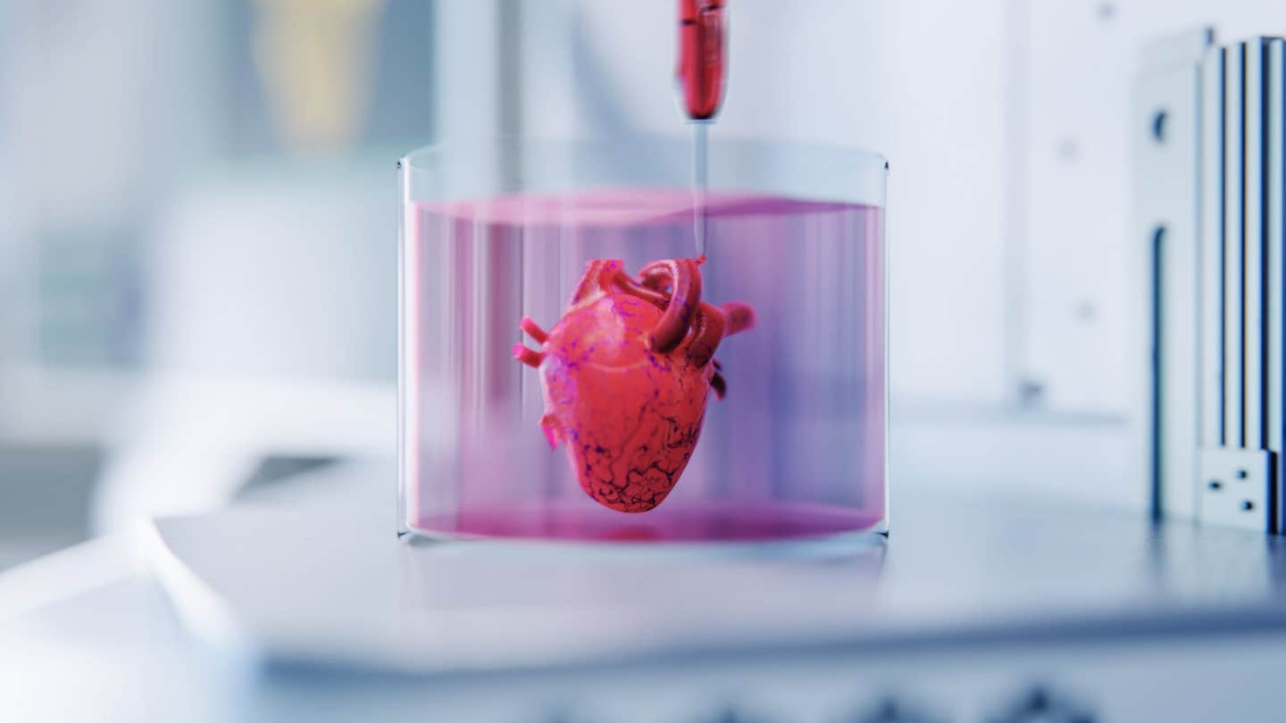Michigan State University scientists have built tiny beating heart organoids that can be driven into atrial fibrillation with inflammation and brought back toward a steady rhythm with drugs. The model finally gives researchers human based tissue to study arrhythmias, speed drug discovery and move toward personalized heart treatments.