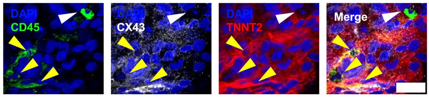 hHMAs contain functional cardiac TRMPs that couple to the electrical system and perform efferocytosis