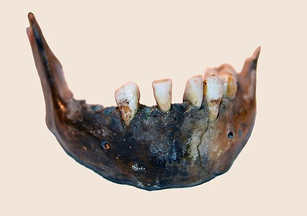 The mandible of a woman who lived 7,900 years ago. The remains were found at Matjes River in southern Africa. The material is kept at the Bloemfontein Museum in South Africa.