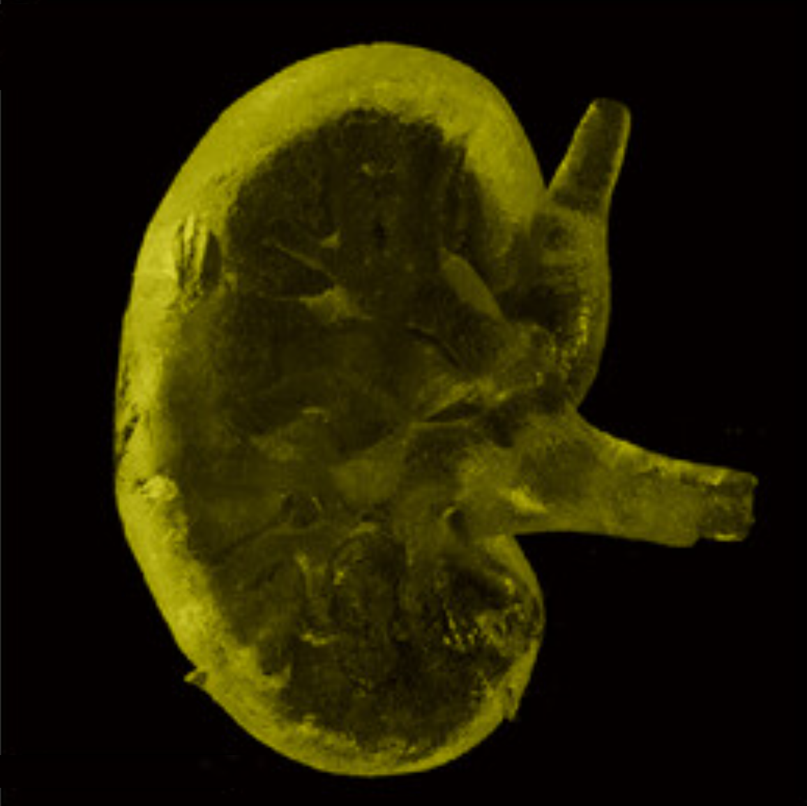 A University of Virginia team has redesigned the common biomedical polymer PEG into a soft, stretchable and 3D-printable material that stays friendly to living cells and even conducts ions, opening new paths for artificial organs, soft implants and flexible solid state batteries.