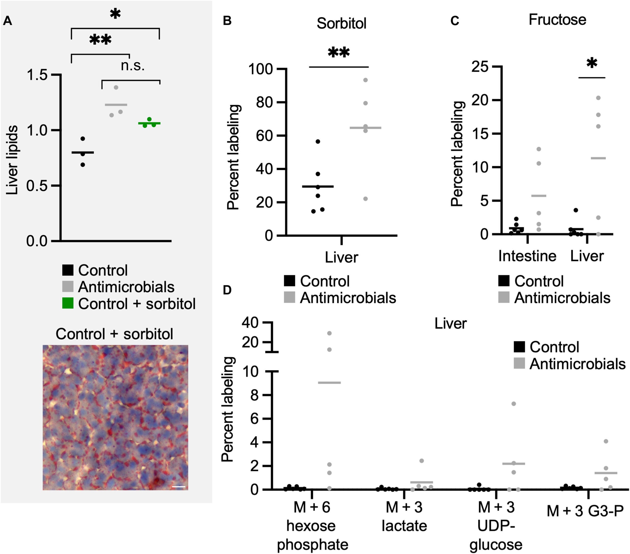 Dietary sorbitol affects hepatic metabolism.