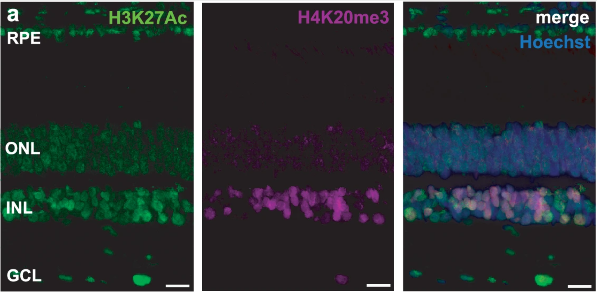 Intact visual circuit and subcellular visual adaptations in the Greenland shark.