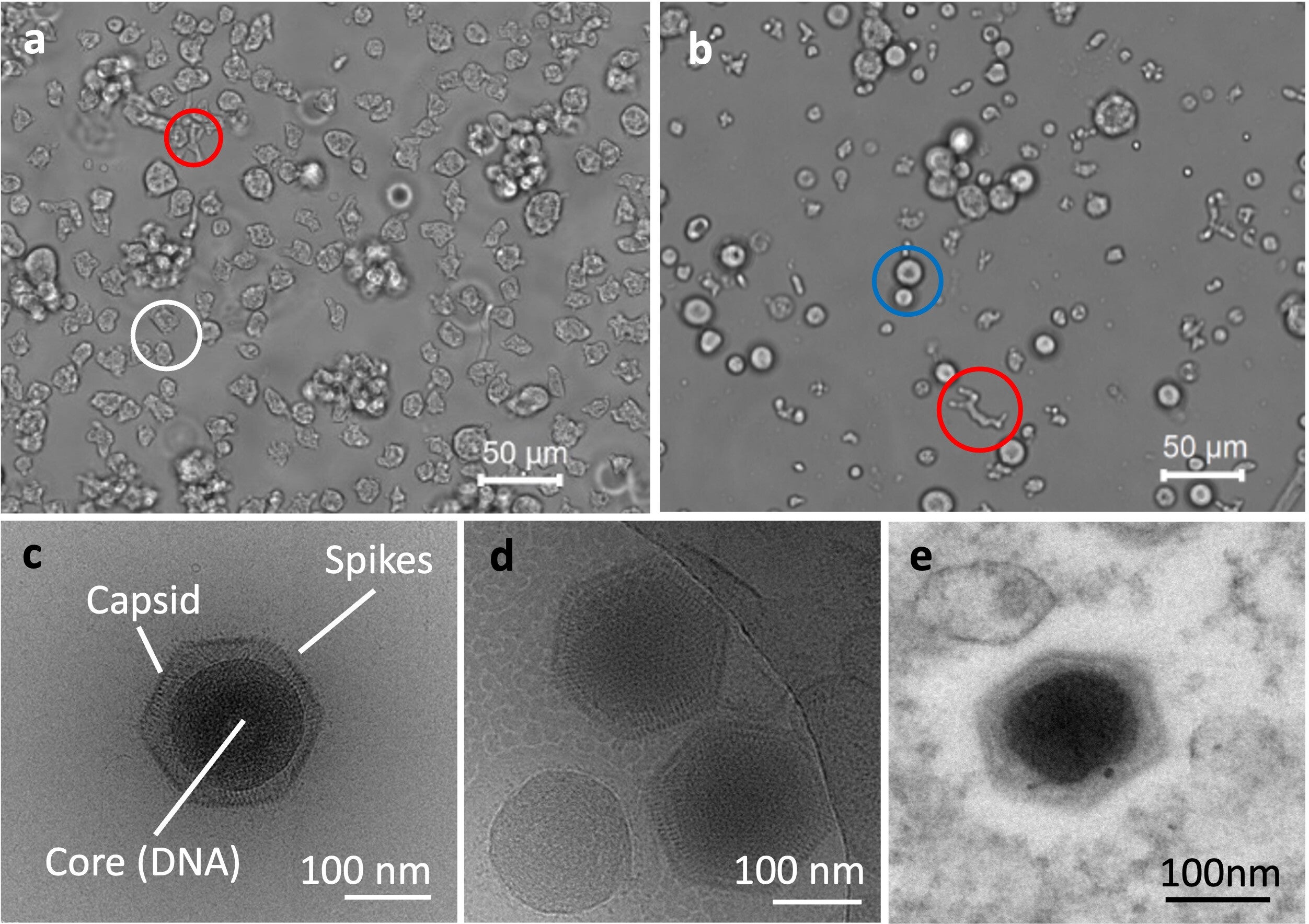 Morphological features of ushikuvirus particles and CPE of infected cells.