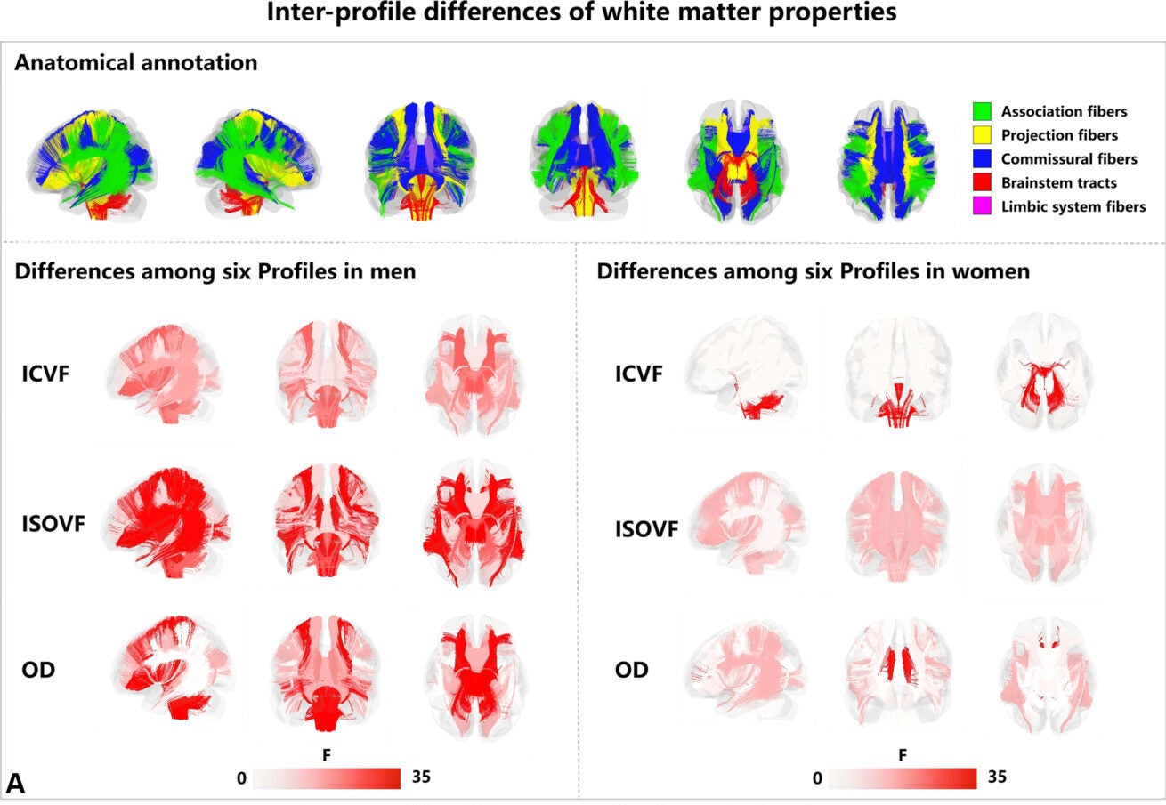 Group comparisons reveal differences across the six profiles in brain white matter properties.
