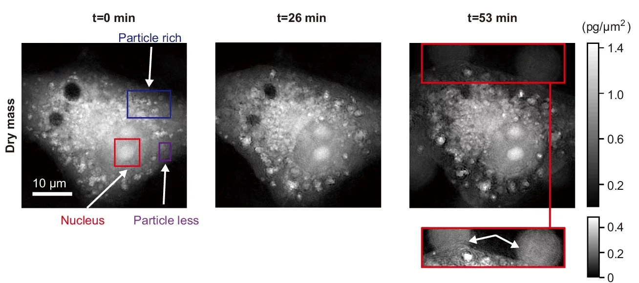Time-lapse observation of intracellular structures and their dynamic motions in the process of cell death.