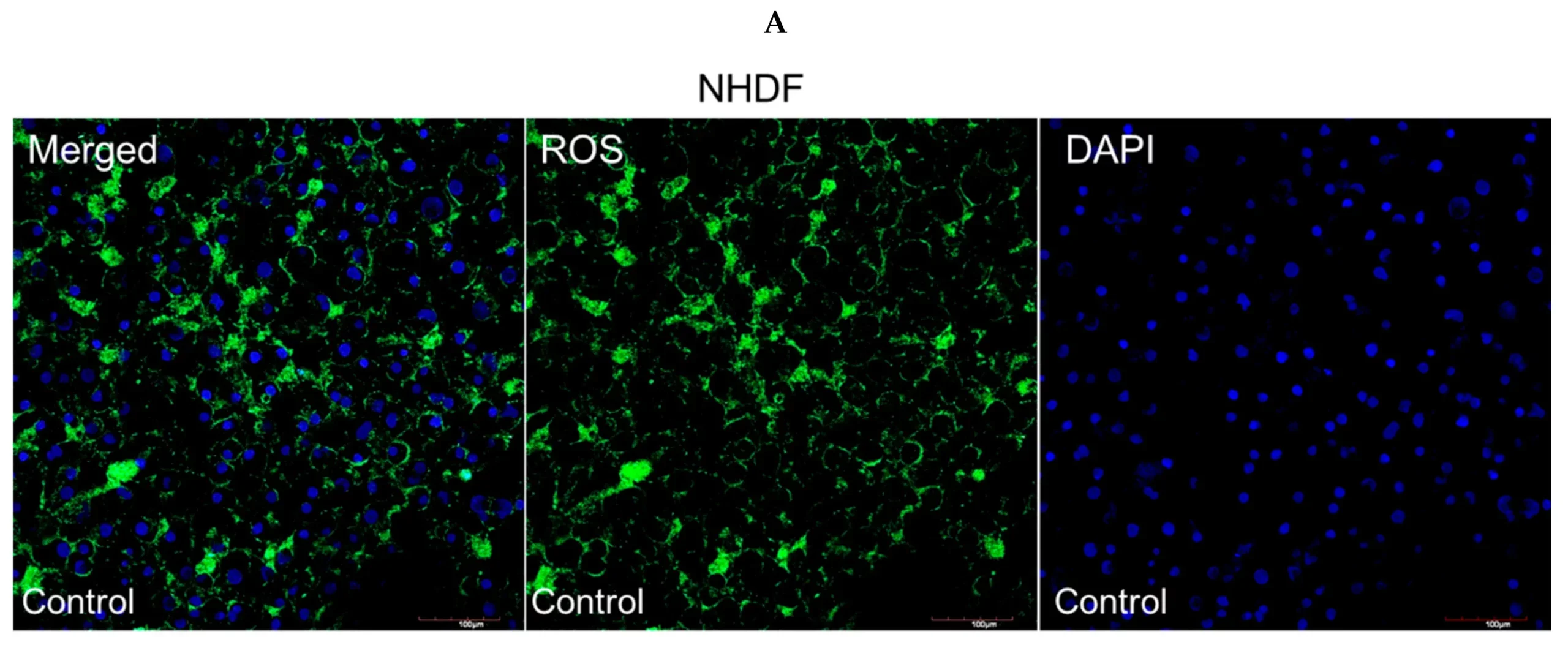 Evaluation of intracellular ROS levels.