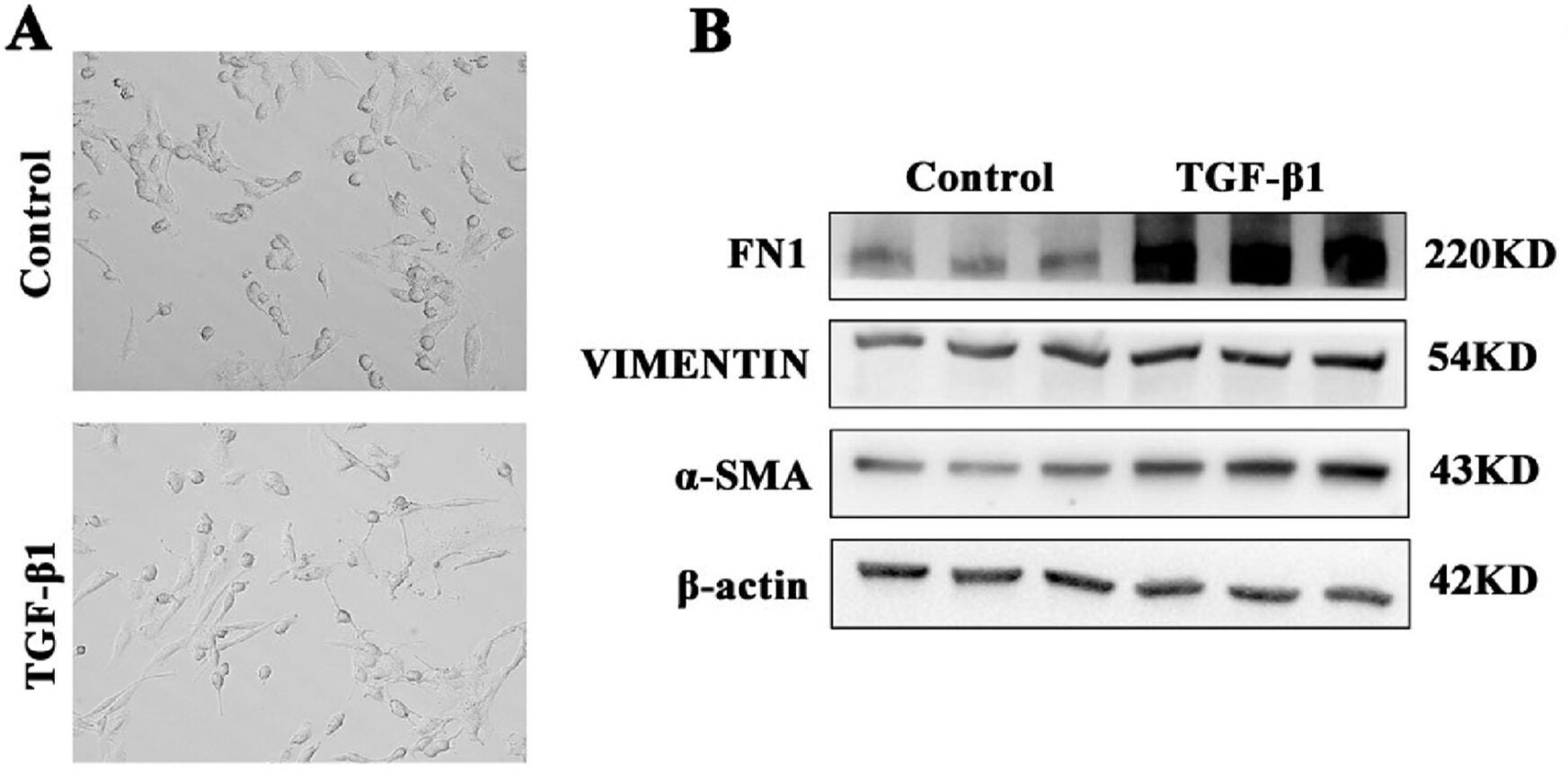 TGF-β1 mediates fibrosis of SRA01/04 cells.