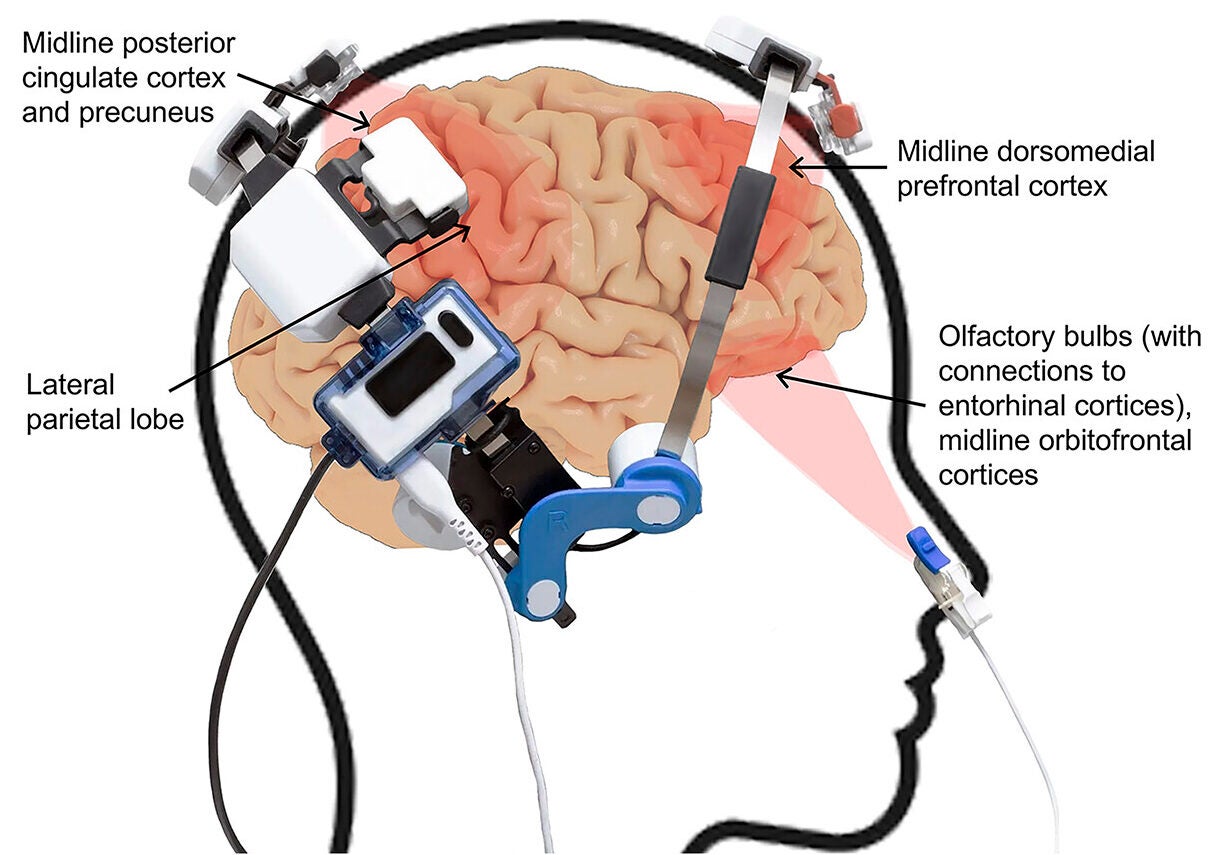 The brain regions targeted by each light-emitting diode (LED)