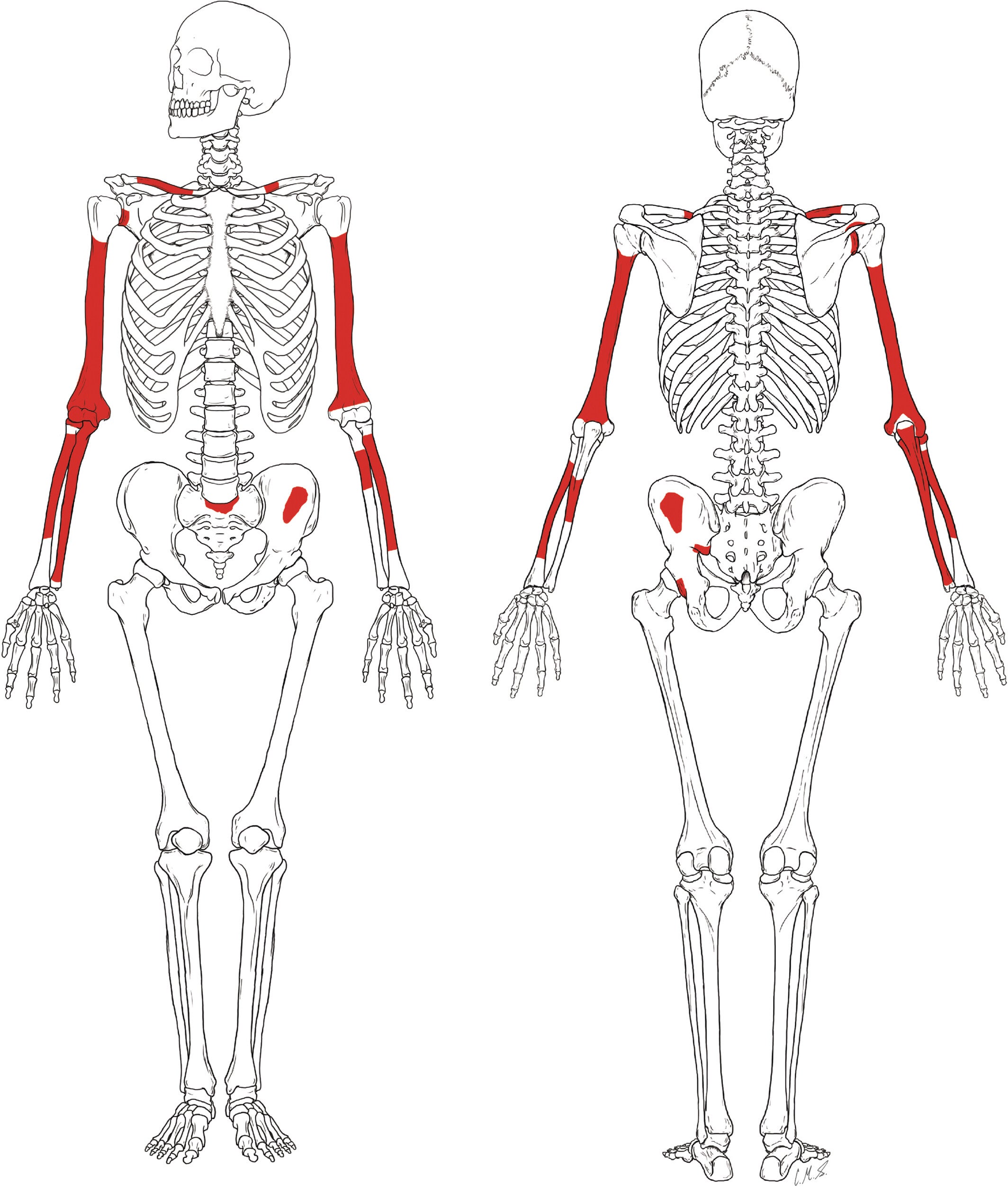 Representation of the postcranial elements preserved by KNM-ER 64061 in anterior (left) and posterior (right) views.

