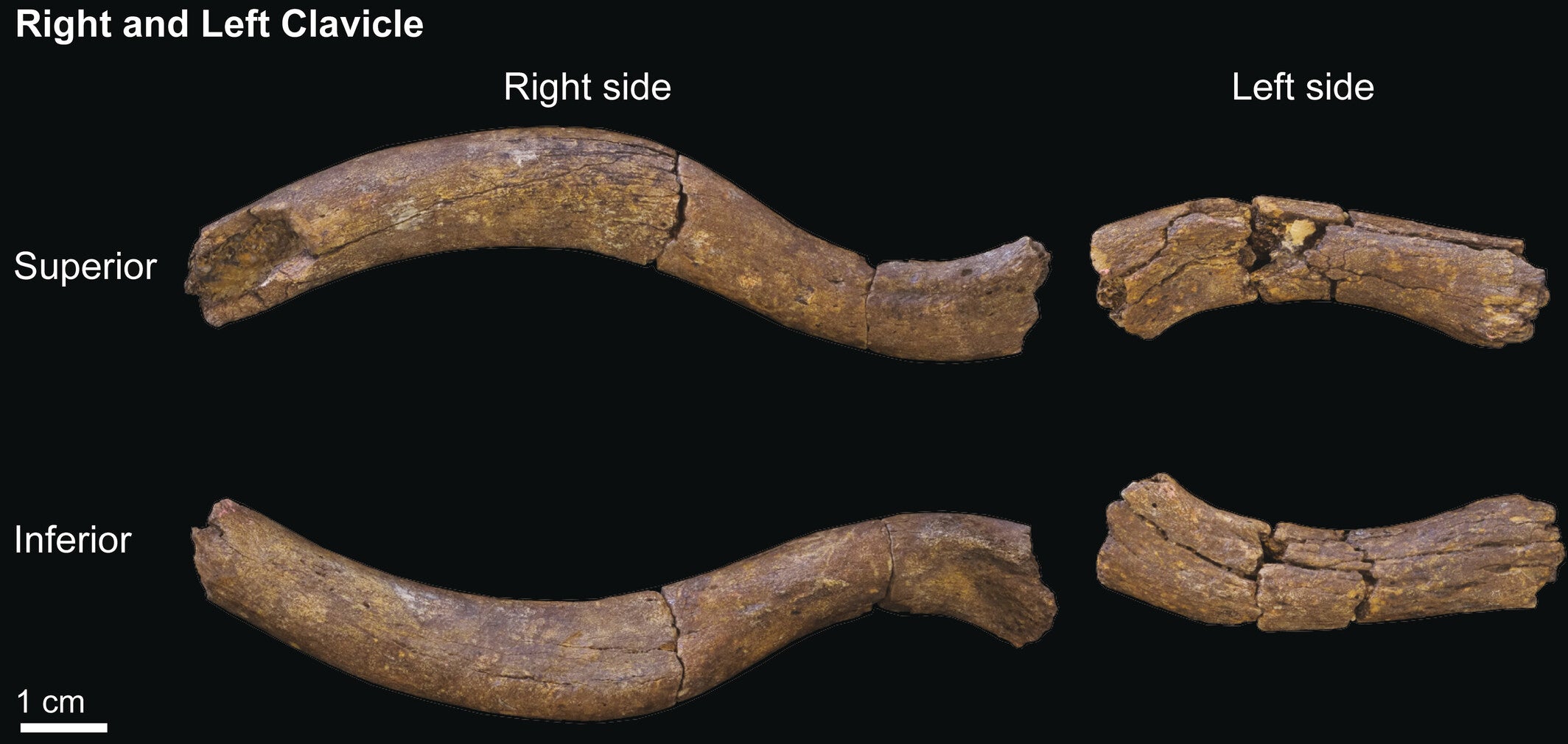 The right and left clavicles of KNM-ER 64061 in superior and inferior views.