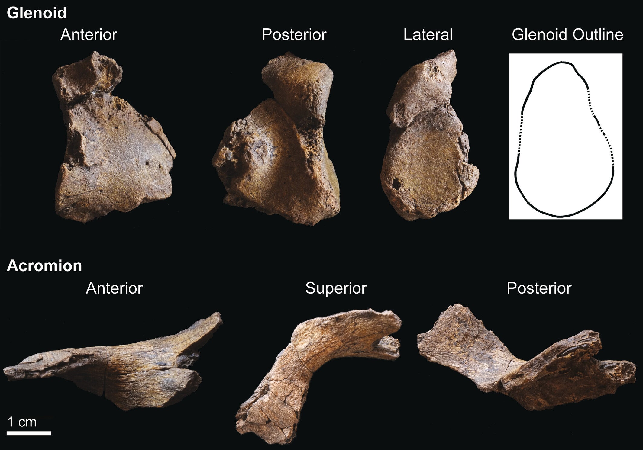 The KNM-ER 64061 right scapular fragments.