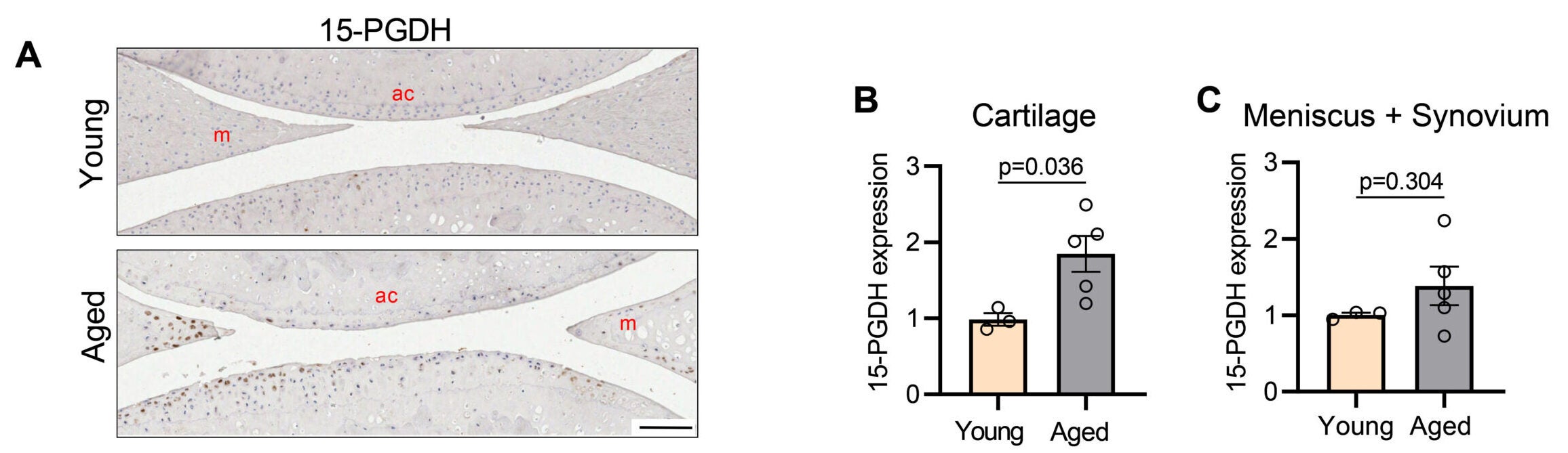 Increased expression of 15-PGDH in aged joint cartilage and its systemic inhibition leading to cartilage regeneration.