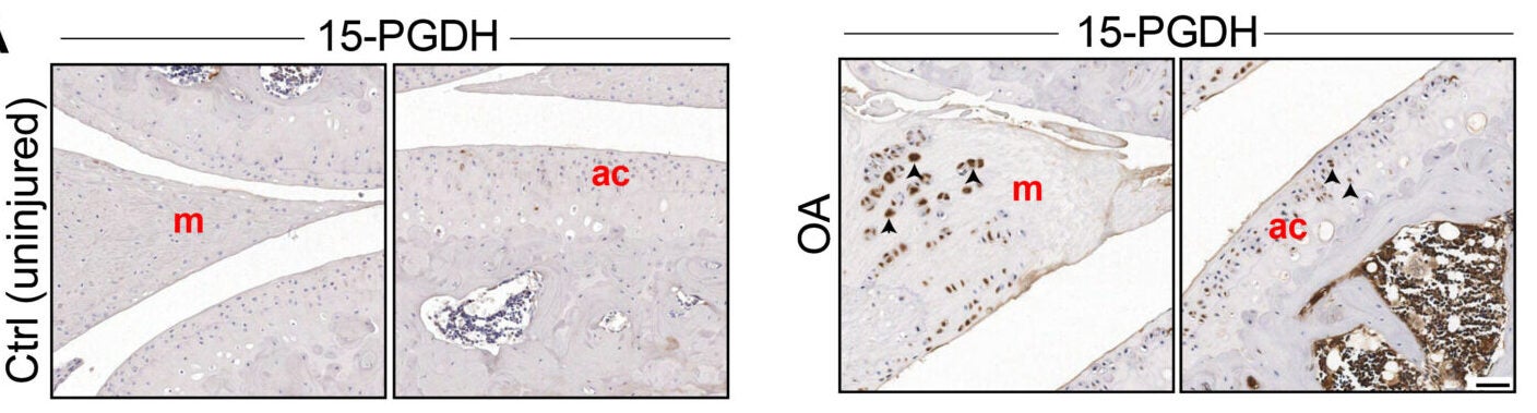 Attenuated post-traumatic OA (PTOA) in young adult mice after inhibition of 15-PGDH by intra-articular injections.