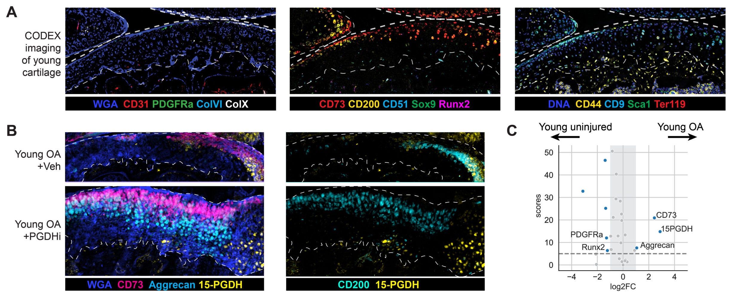 Effects of PGDHi on spatial distribution and composition of chondrocyte subsets in post-traumatic OA and aged cartilage.