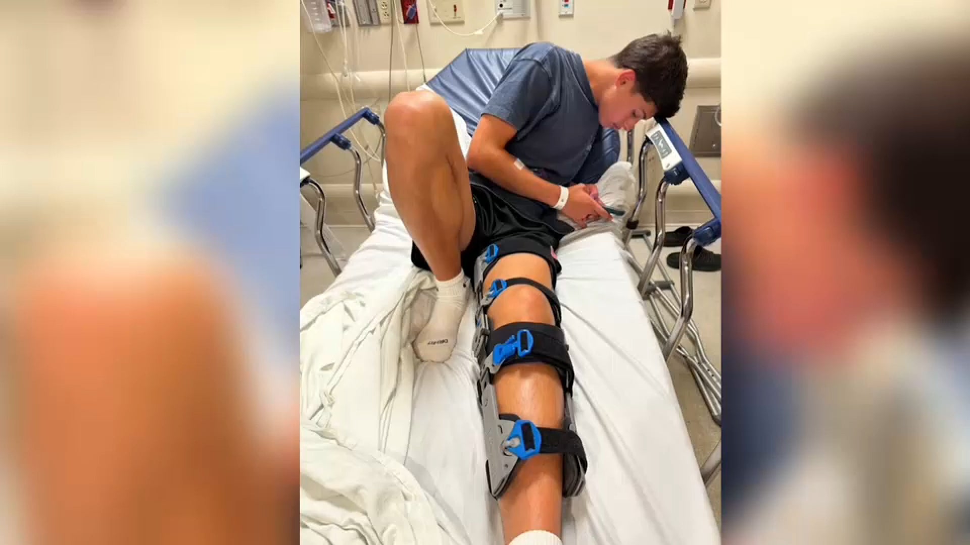 Ranawat performed what surgeons call an “around the world” procedure, reconstructing all four ligaments in a single operation.