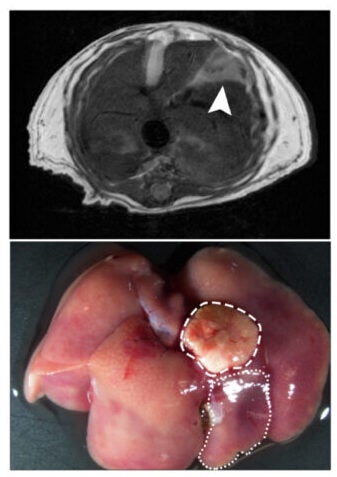MRI (top) and gross imaging (bottom) of mouse spontaneous HCC. The dashed line indicates a tumor, and the dotted line indicates adjacent normal.
