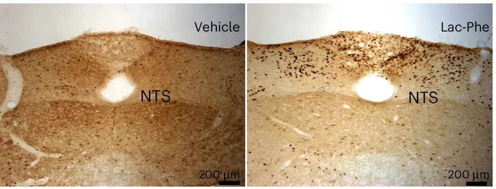 Lac-Phe suppresses feeding and activates PVH neurons.