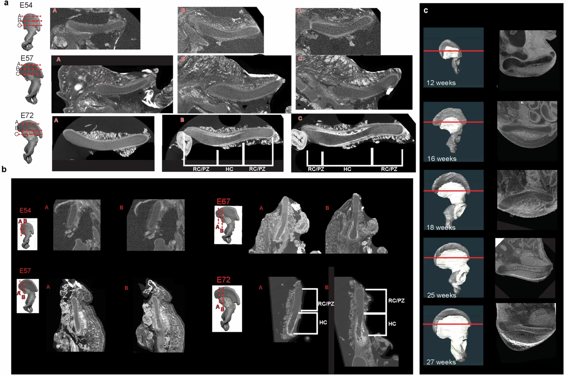 Comparative microCT sections of the growth plate of human and primates.